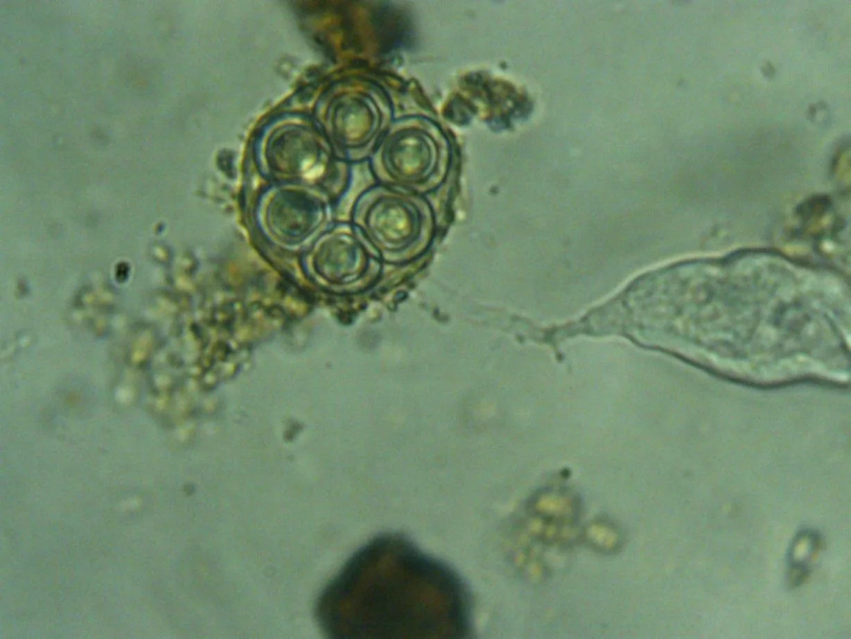 Microscope view of a rounded microbial structure holding several spherical bodies