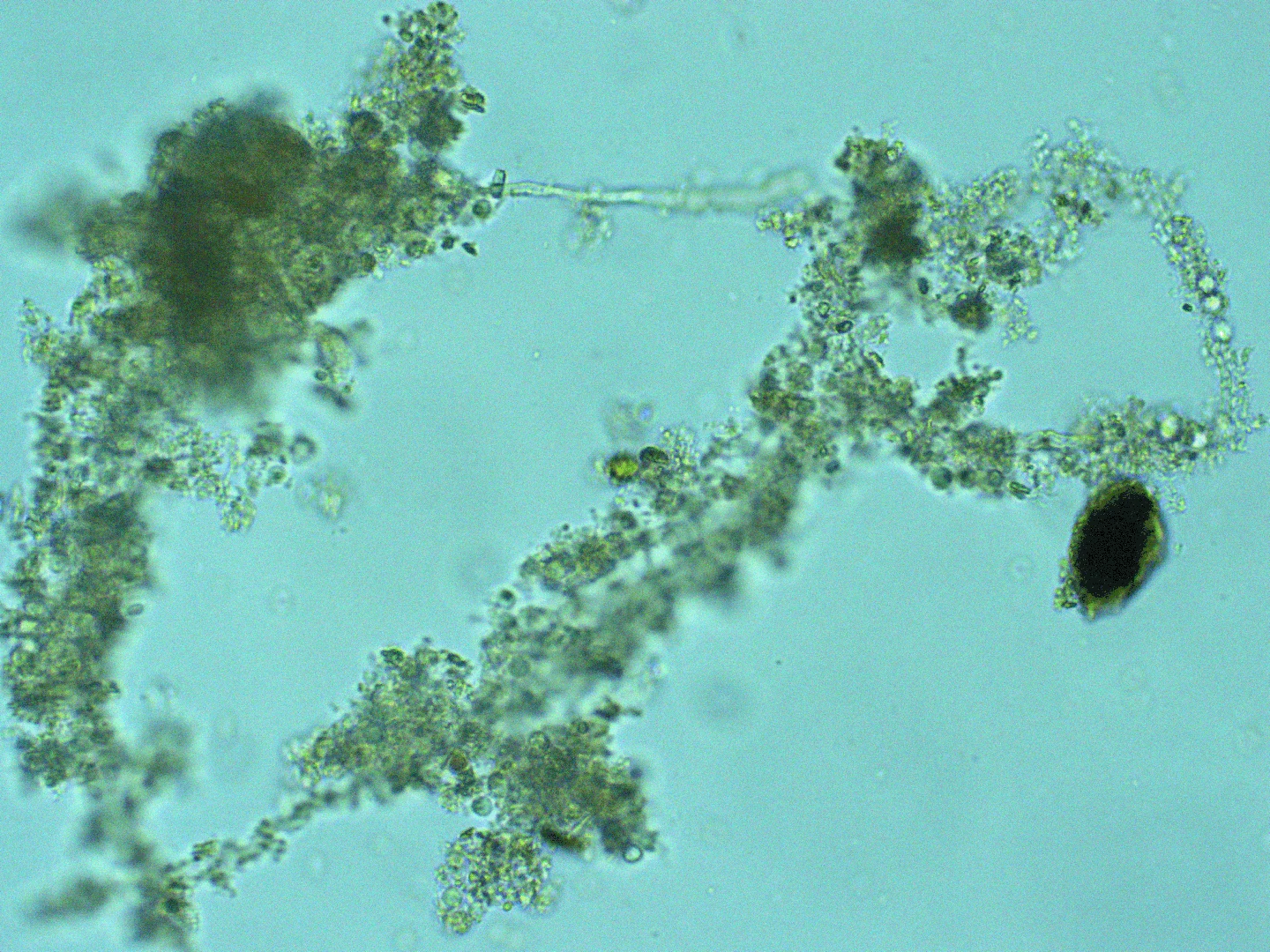 Microscope view of MetaGrow F Comp